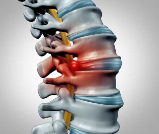 Spine-Infection